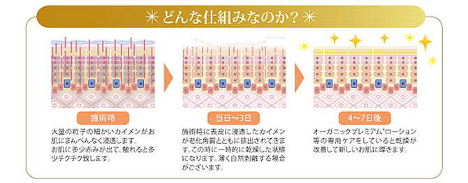 しくみ しくみ