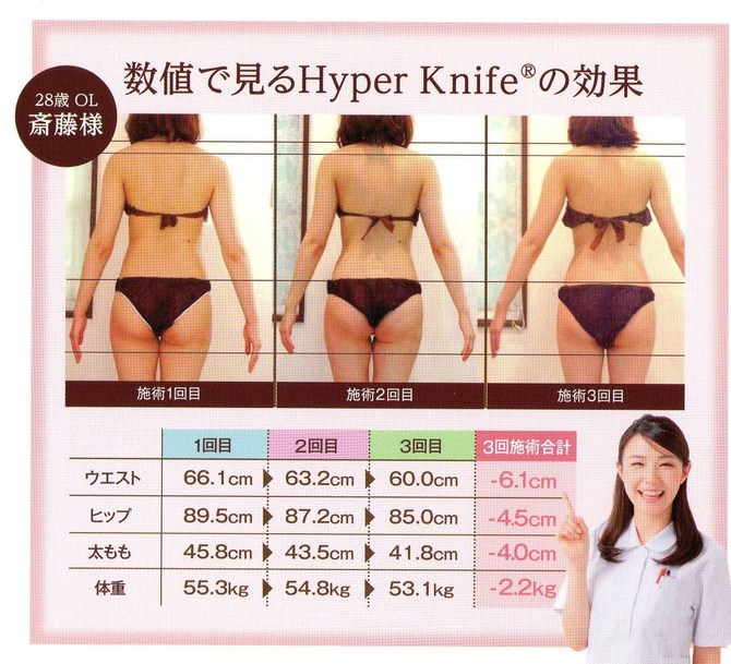 ハイパーの効果について ハイパーの効果について